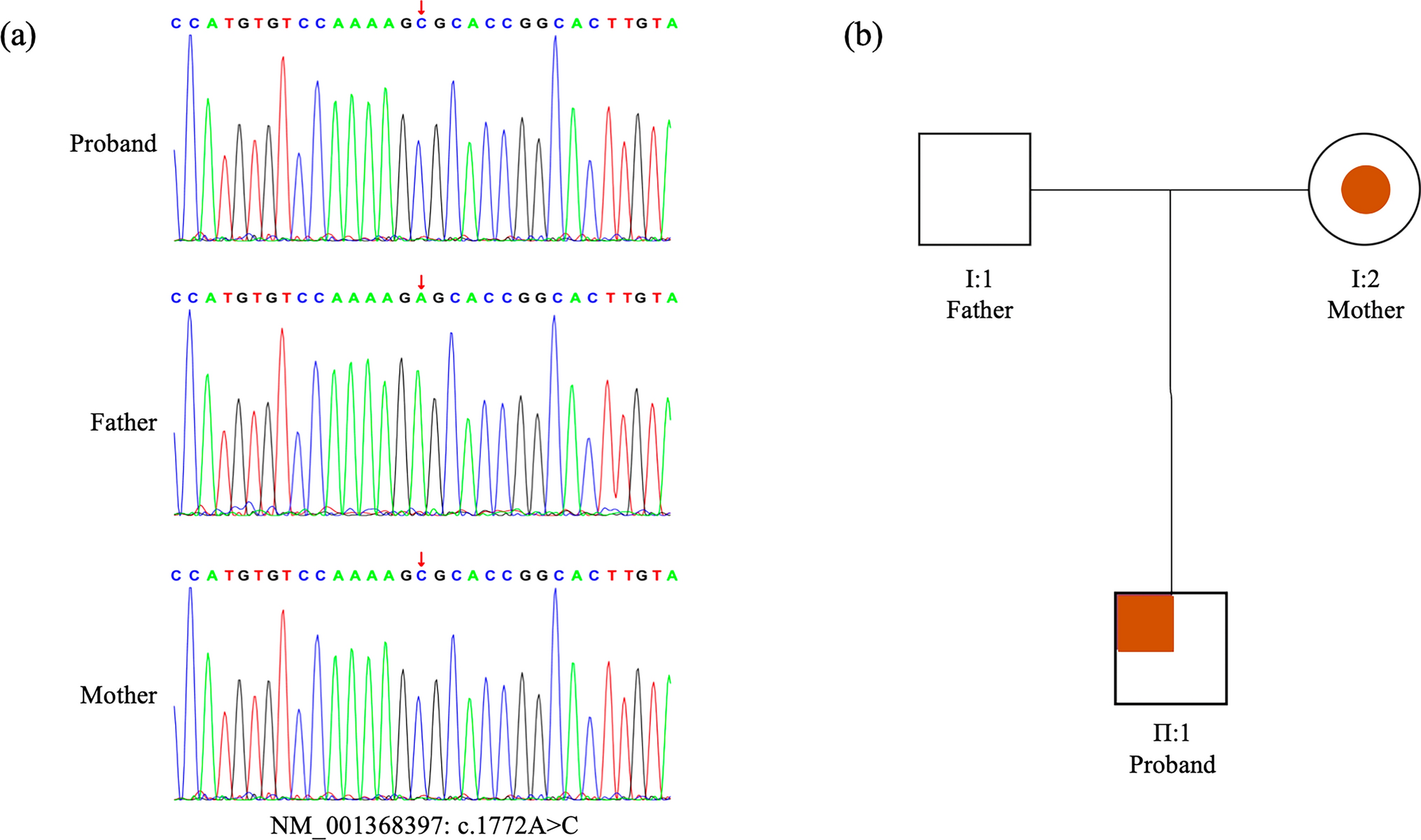 Genetic analysis of a child with severe intellectual disability caused by a novel variant in the FERM domain of the FRMPD4 protein