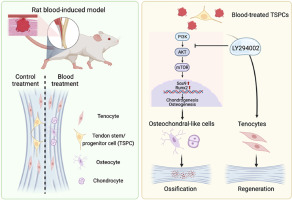 Inhibition of PI3K/AKT signaling pathway prevents blood-induced heterotopic ossification of the injured tendon