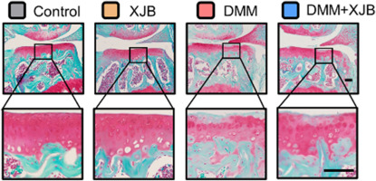 XJB-5-131 protects chondrocytes from ferroptosis to alleviate osteoarthritis progression via restoring Pebp1 expression