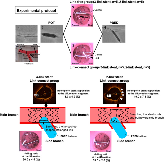 Impact of stent strut link location in proximal balloon edge dilation technique for bifurcation percutaneous coronary intervention