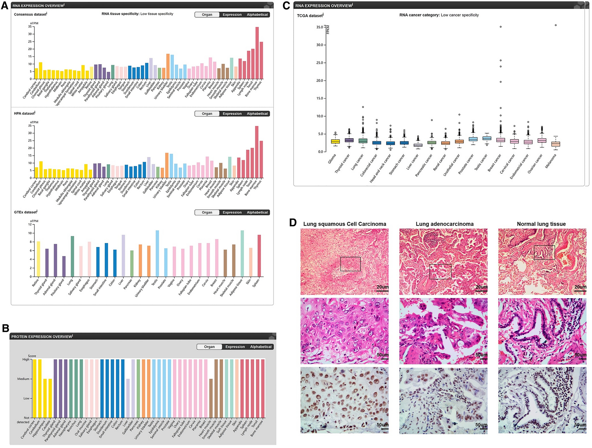 GABPB1 plays a cancer-promoting role in non-small cell lung cancer
