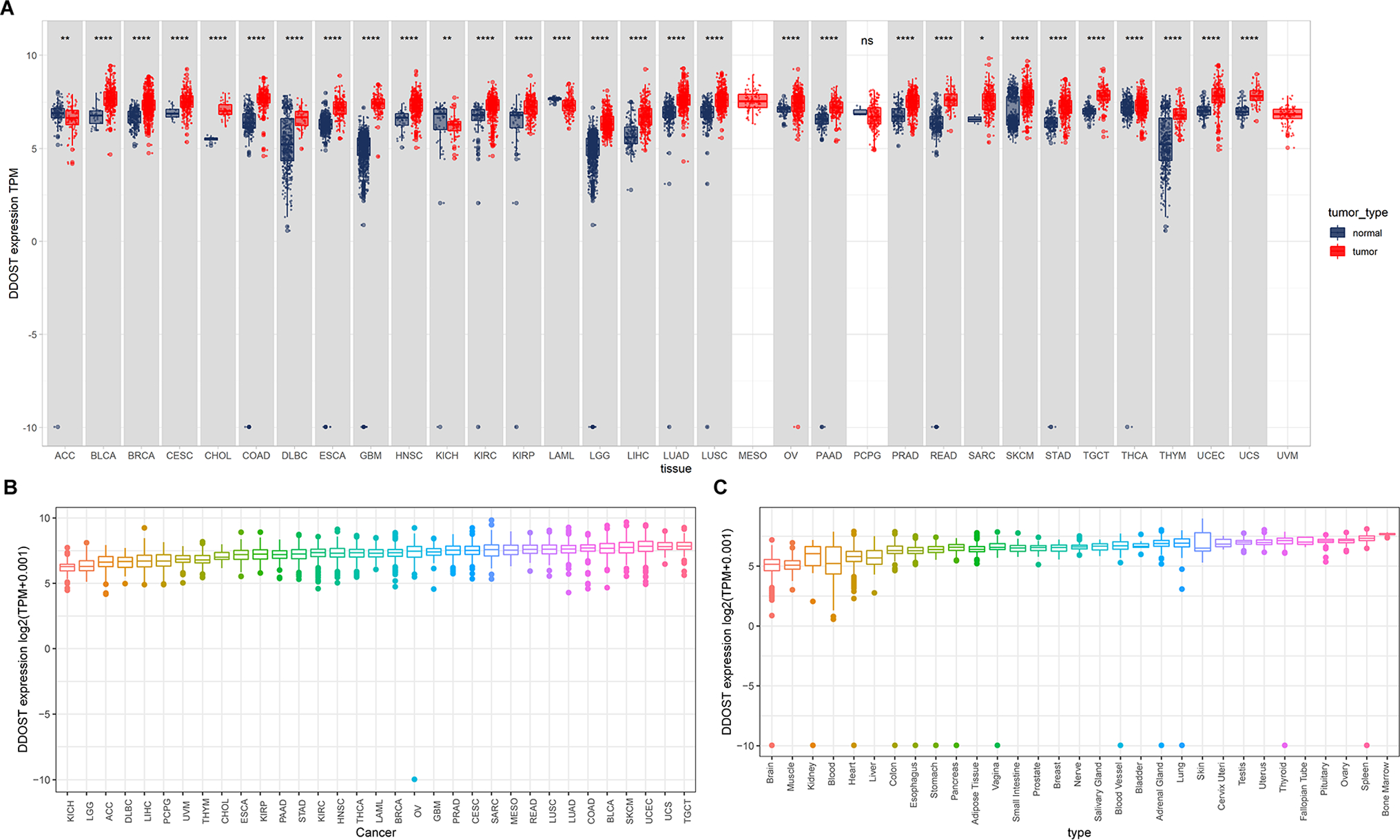 DDOST is associated with tumor immunosuppressive microenvironment in cervical cancer