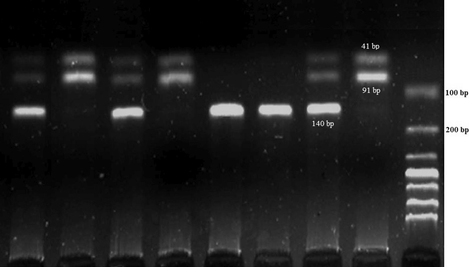 The prevalence of ADSL (rs3788579) and CYP1A2 (rs17861162) polymorphisms in female breast cancer patients in North-West Iran