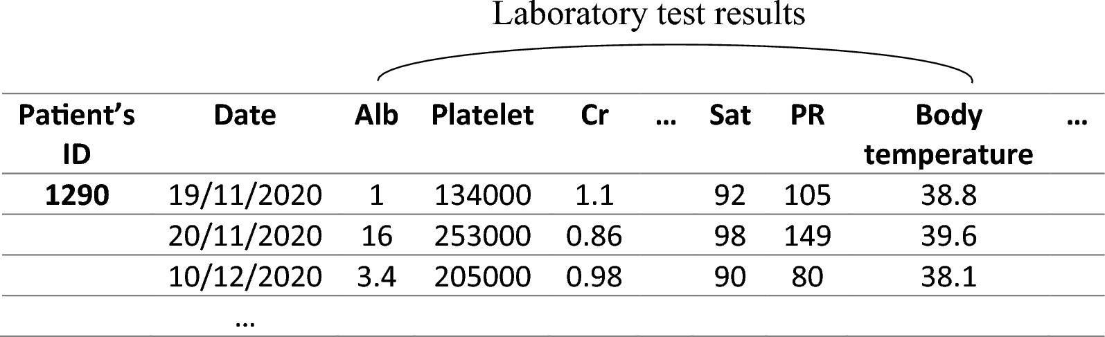 Efficient management of pulmonary embolism diagnosis using a two-step interconnected machine learning model based on electronic health records data