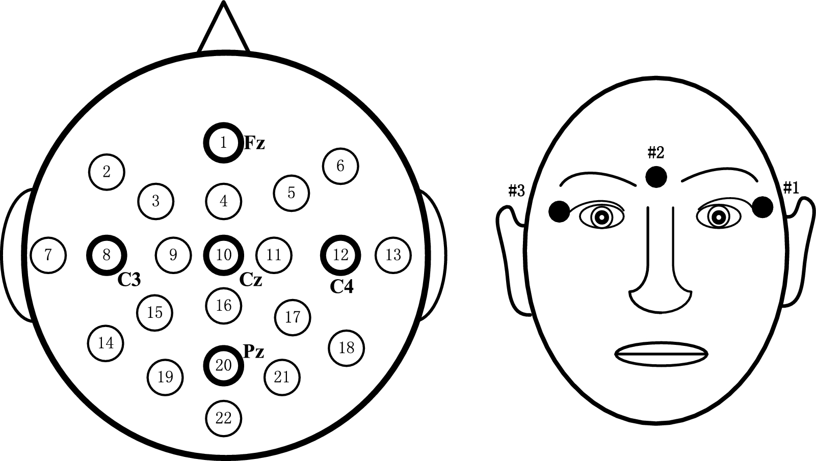 Adaptive filter of frequency bands based coordinate attention network for EEG-based motor imagery classification