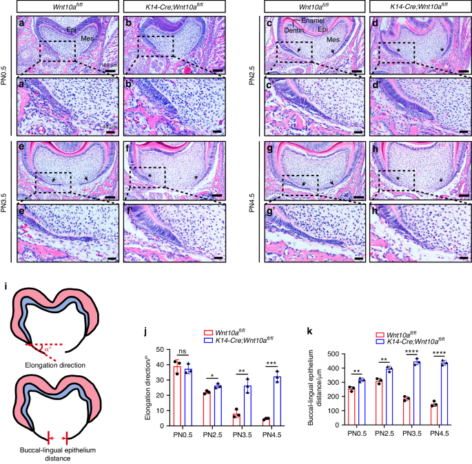 A Wnt10a-Notch signaling axis controls Hertwig’s epithelial root sheath cell behaviors during root furcation patterning