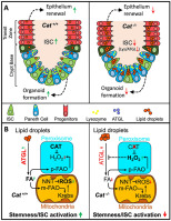 The loss of antioxidant activities impairs intestinal epithelium homeostasis by altering lipid metabolism