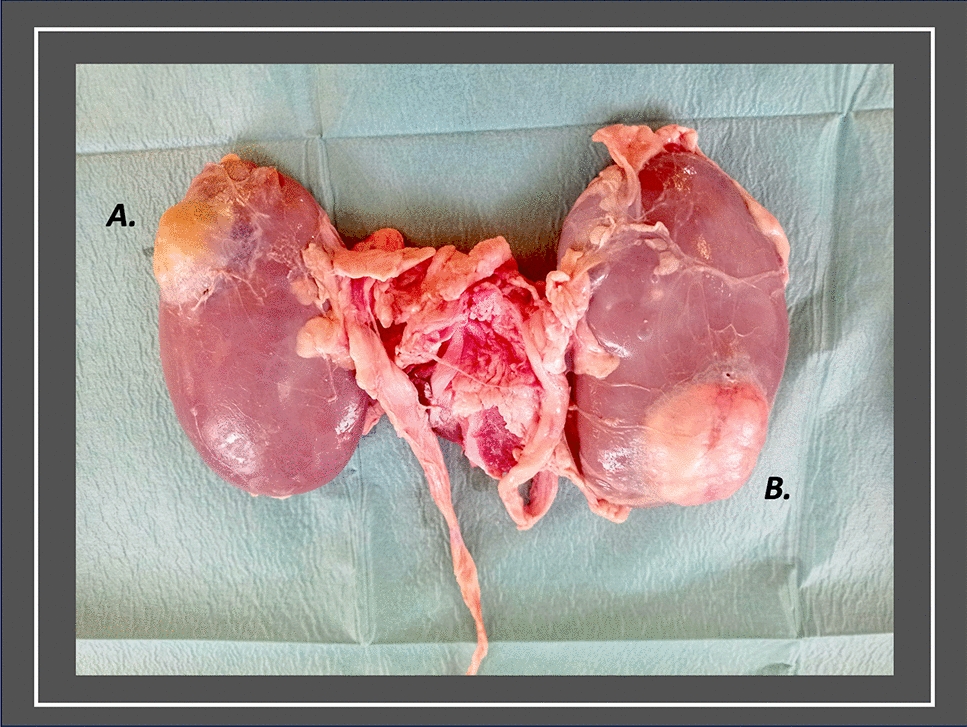 Design and utilisation of a novel, high-fidelity, low-cost, hybrid-tissue simulation model to facilitate training in robot-assisted partial nephrectomy