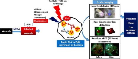 Evaluation of the potential of Delta-aminolevulinic acid for simultaneous detection of bioburden and anti-microbial photodynamic therapy of MRSA infected wounds in Swiss albino mice