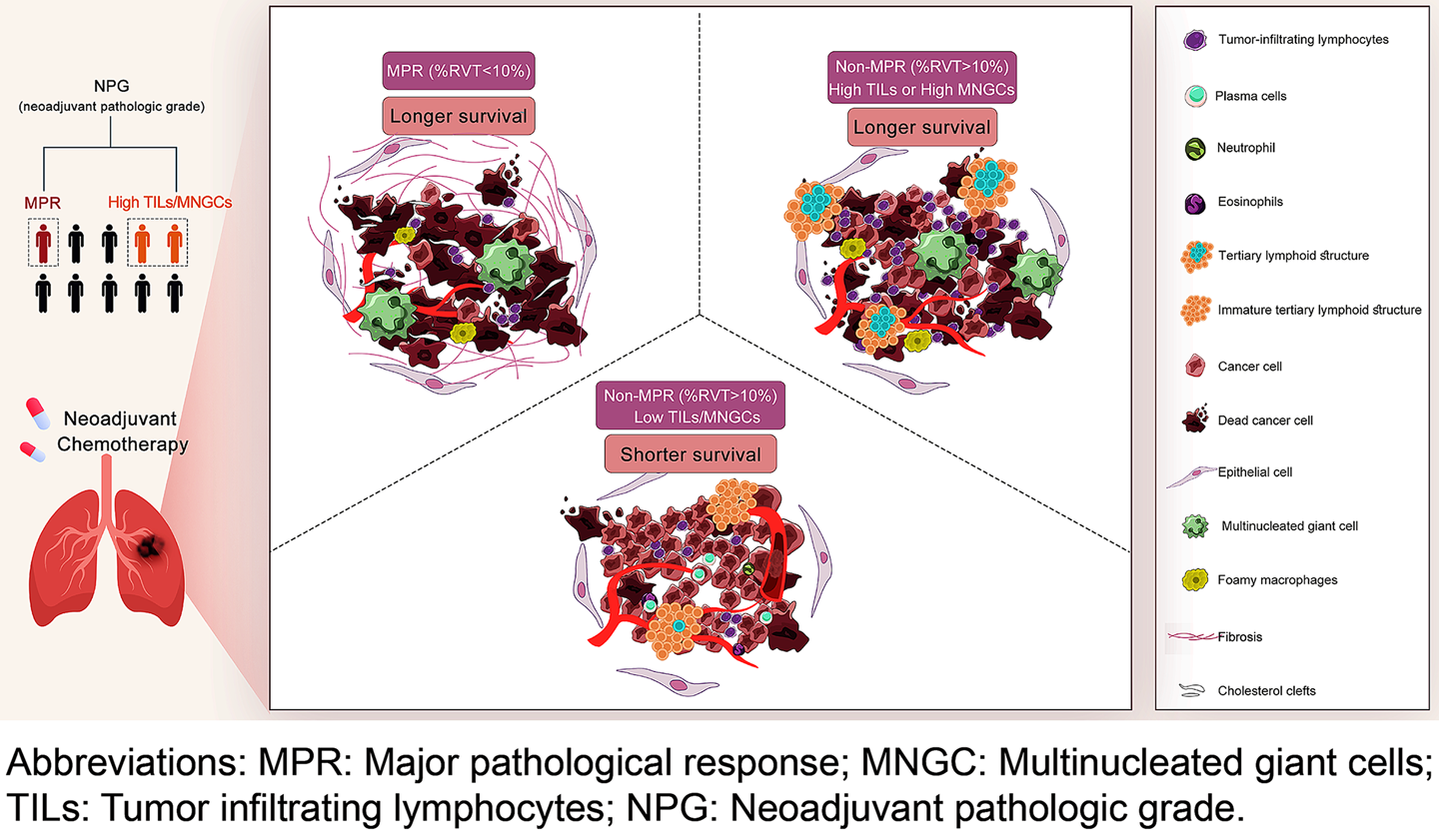 Pathological response and tumor stroma immunogenic features predict long-term survival in non-small cell lung cancer after neoadjuvant chemotherapy