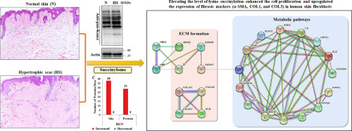 Global proteomic analysis reveals lysine succinylation is involved in the pathogenesis of hypertrophic scar