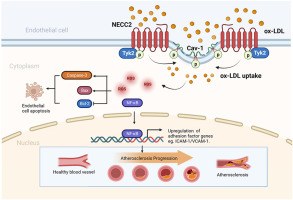 The long coiled-coil protein NECC2 regulates oxLDL-induced endothelial oxidative damage and exacerbates atherosclerosis development in apolipoprotein E −/− mice