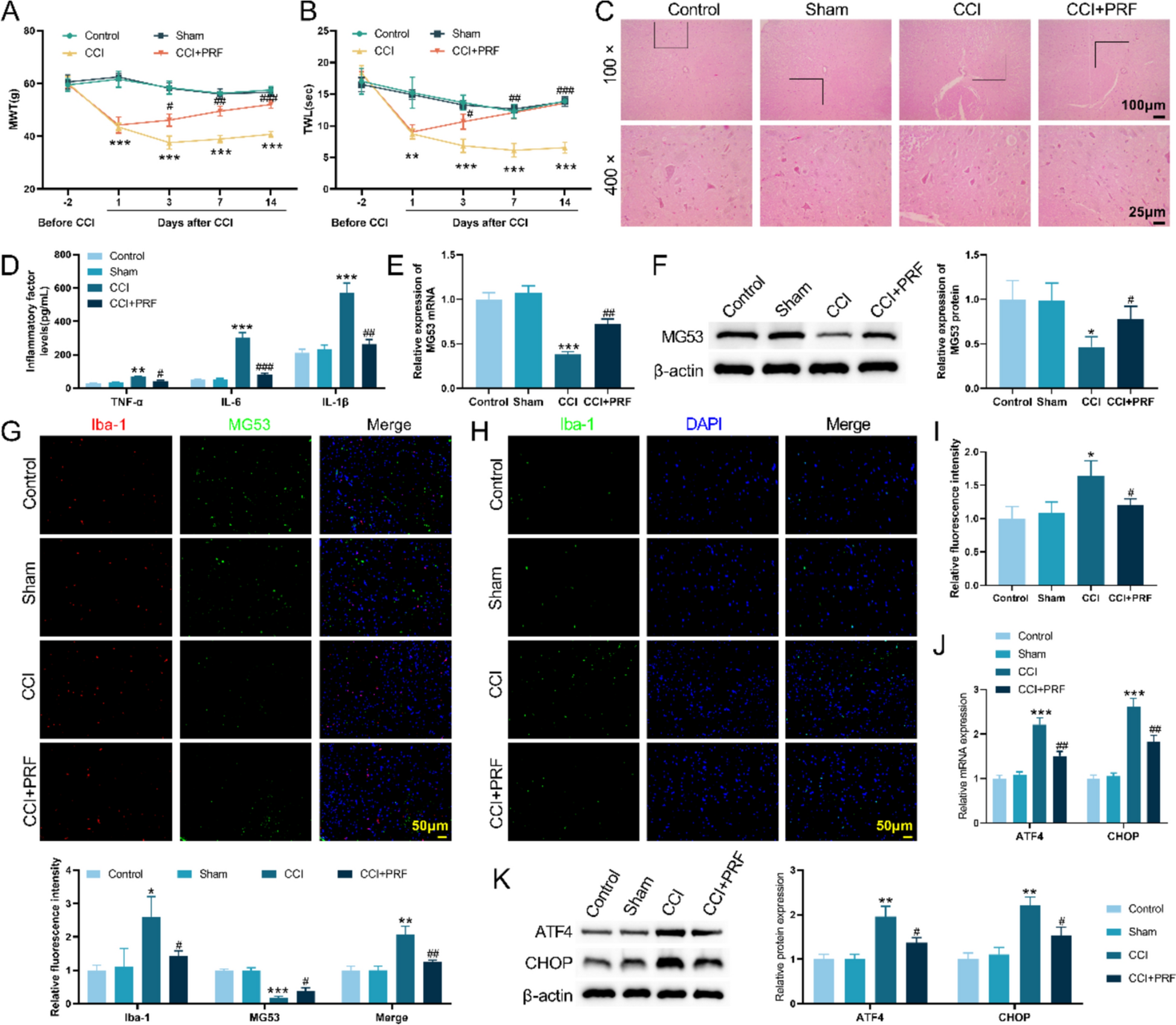 Pulsed radiofrequency alleviates neuropathic pain by upregulating MG53 to inhibit microglial activation