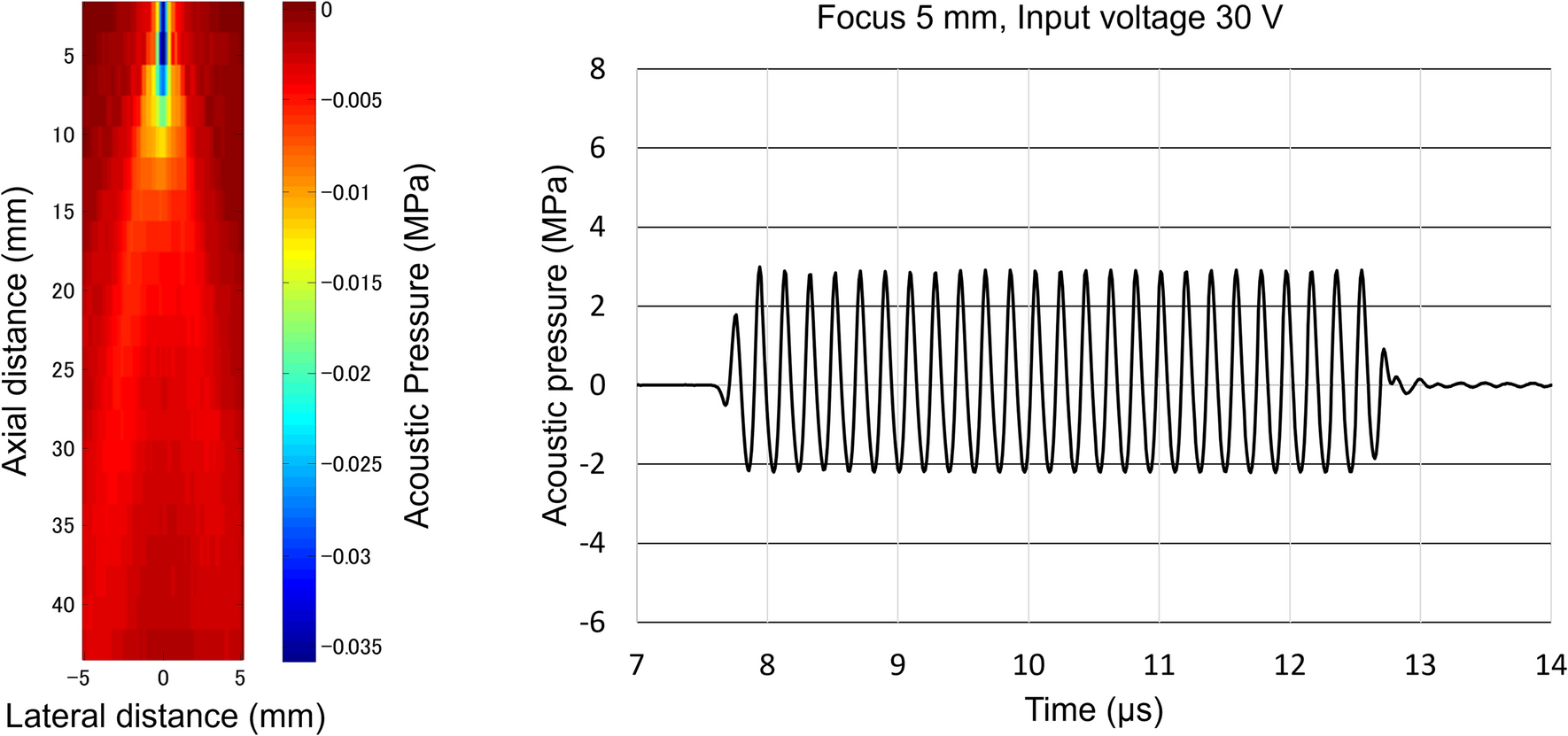 Acoustic radiation force impulse (push pulse)-induced lung hemorrhage: investigating the effect of ultrasound contrast agent in rabbits