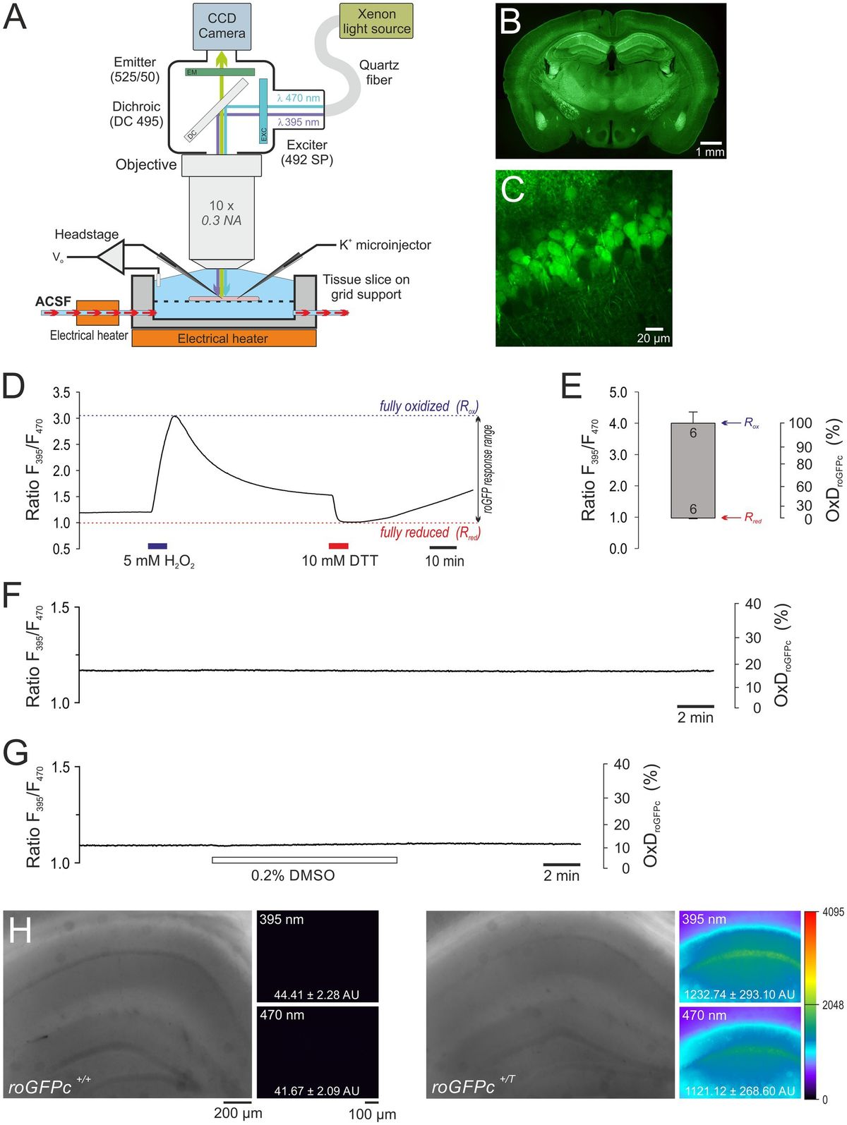 Quantitative, real-time imaging of spreading depolarization-associated neuronal ROS production