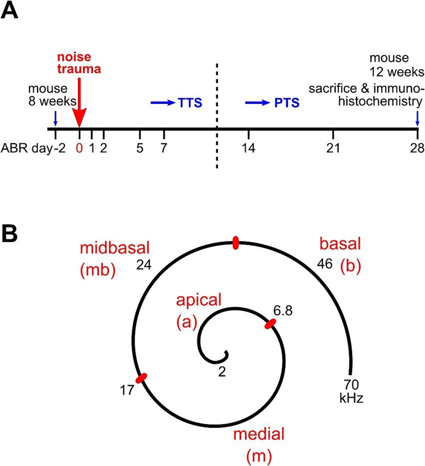 Noise-induced cochlear synaptopathy in C57BL/6 N mice as a function of trauma strength: ribbons are more vulnerable than postsynapses