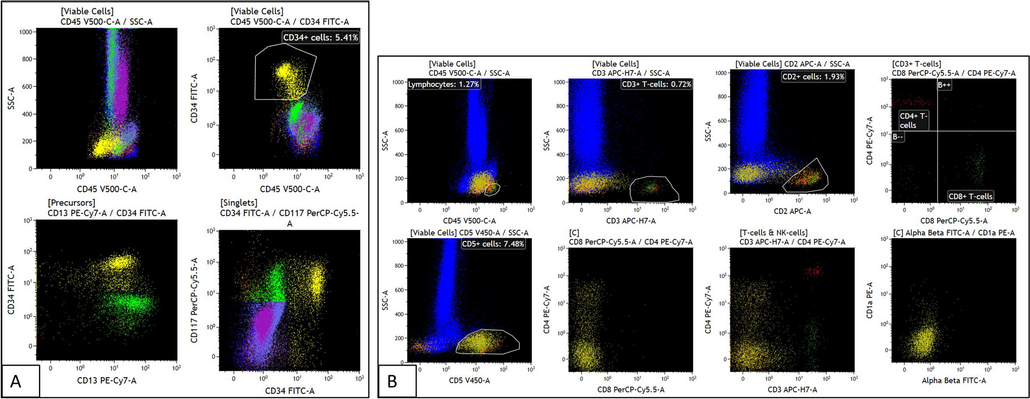 Navigating diagnostic dilemmas: a rare presentation of extramedullary T-lymphoblastic leukemia/lymphoma with chronic myeloid leukemia