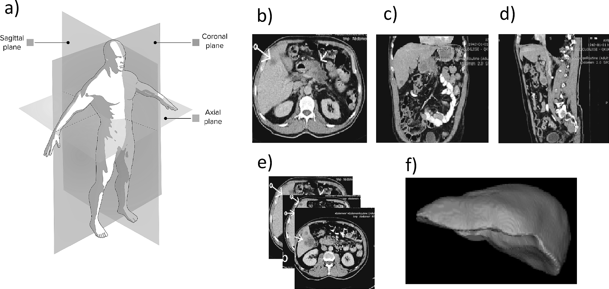 Semantic Segmentation of CT Liver Structures: A Systematic Review of Recent Trends and Bibliometric Analysis