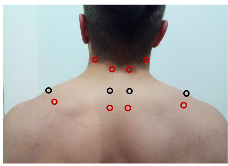 Immediate effects of traditional and laser acupuncture in chronic non-specific neck pain: a randomized controlled clinical trial