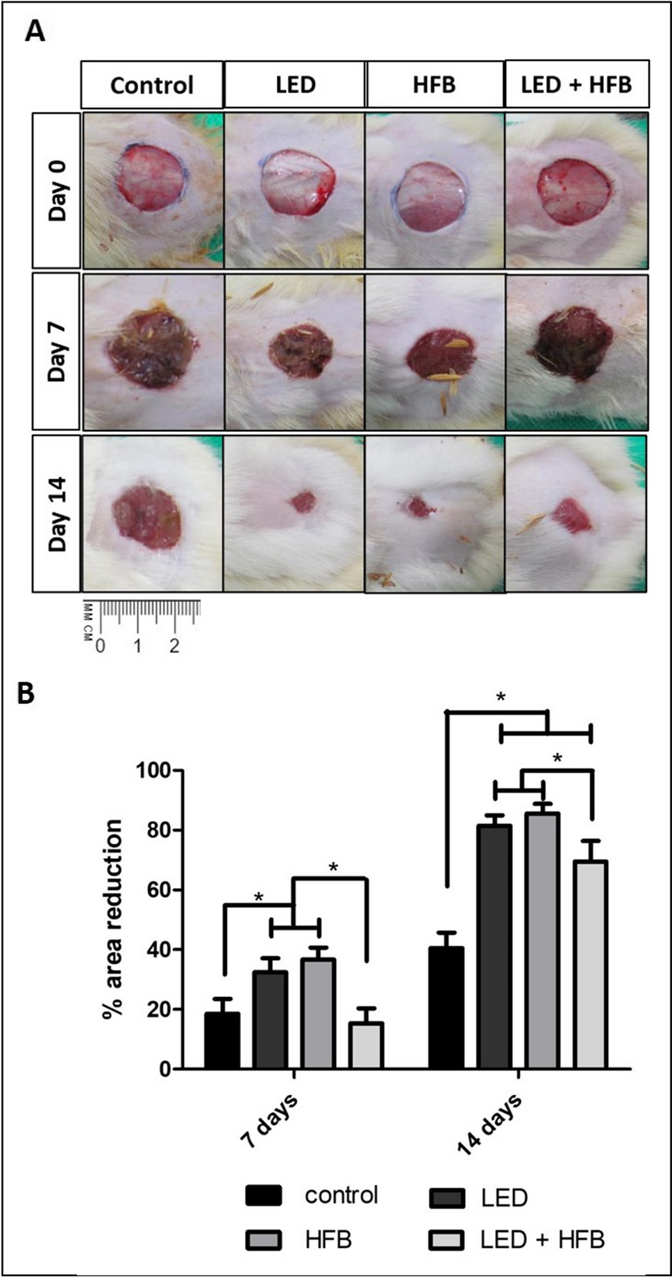 Diabetic rats skin wounds treated with heterologous fibrin sealant followed by photobiomodulation therapy