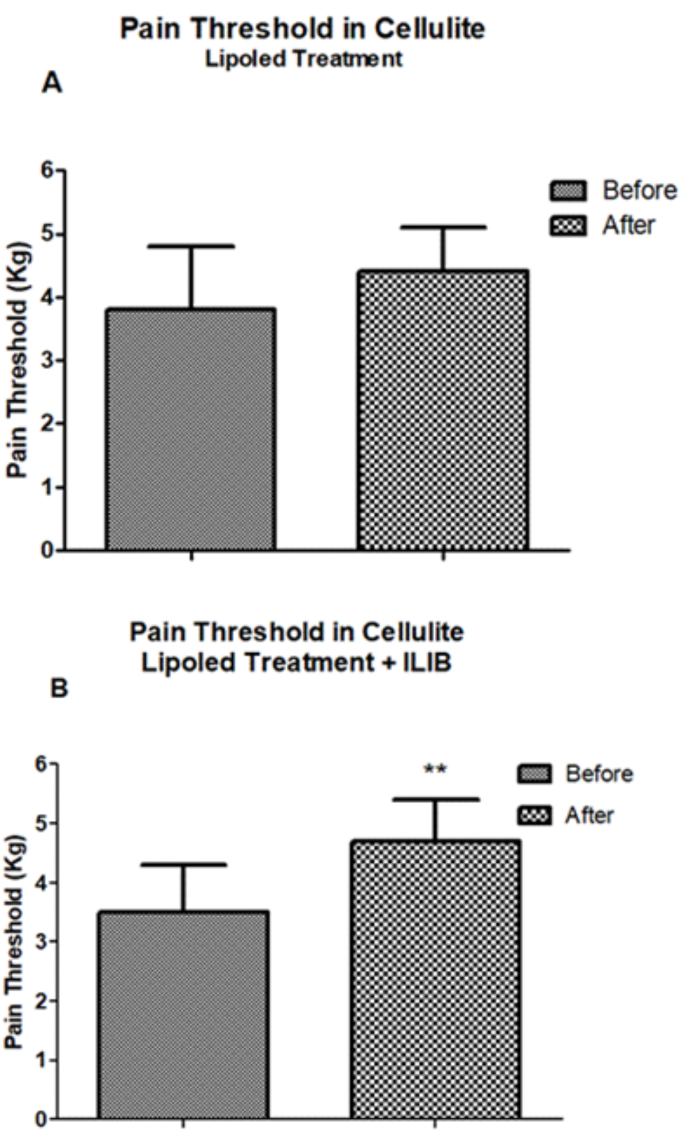 Local and systemic photobiomodulation using a 650 nm LED on skin temperature and hyperalgesia in cellulite: a randomized, placebo-controlled and double-blinded clinical trial