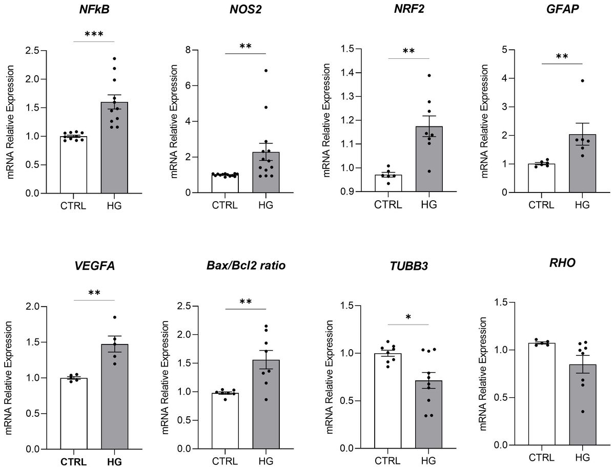 Effects of mesenchymal stromal cells and human recombinant Nerve Growth Factor delivered by bioengineered human corneal lenticule on an innovative model of diabetic retinopathy