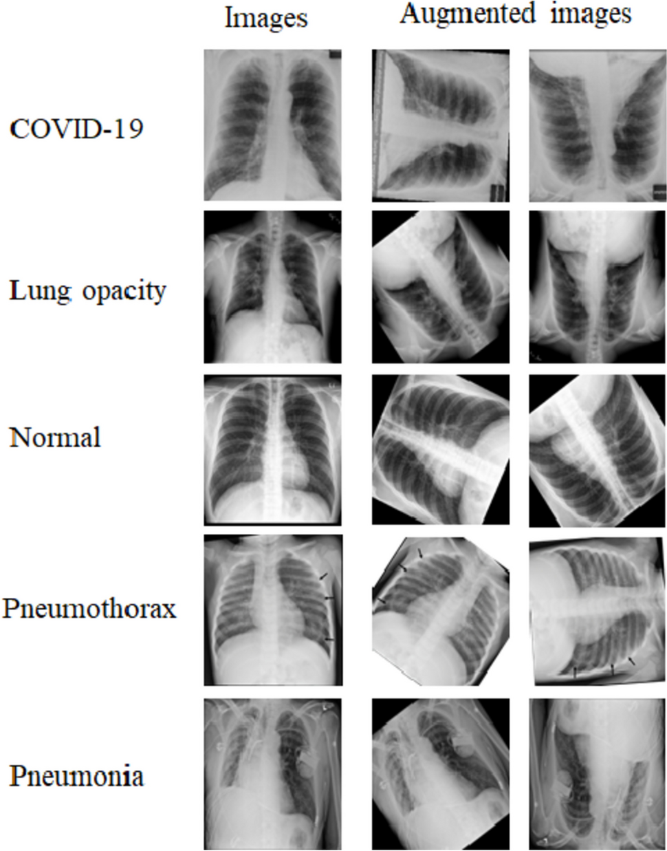 Diagnosing Respiratory Variability: Convolutional Neural Networks for Chest X-ray Classification Across Diverse Pulmonary Conditions