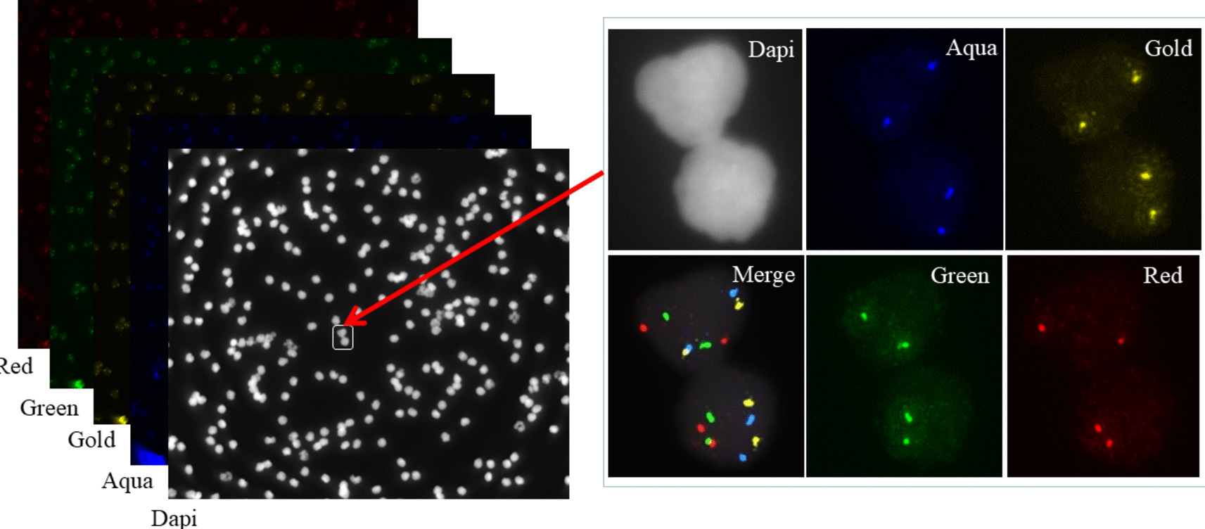 CACs Recognition of FISH Images Based on Adaptive Mean Teacher Semi-supervised Learning with Domain-Knowledge Pseudo Label