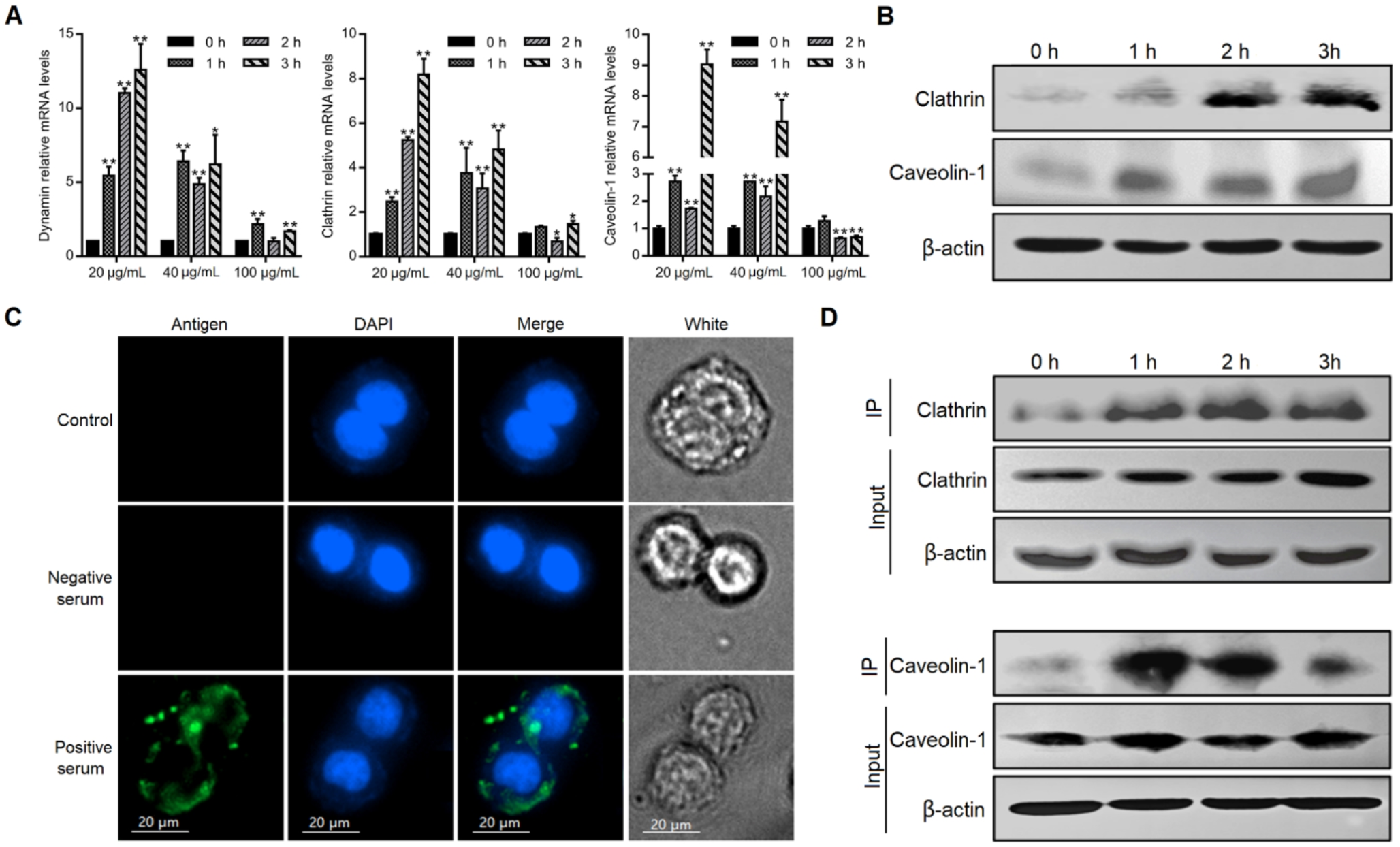 The pathogenic responses elicited during exposure of human intestinal cell line with Giardia duodenalis excretory-secretory products and the potential attributed endocytosis mechanism