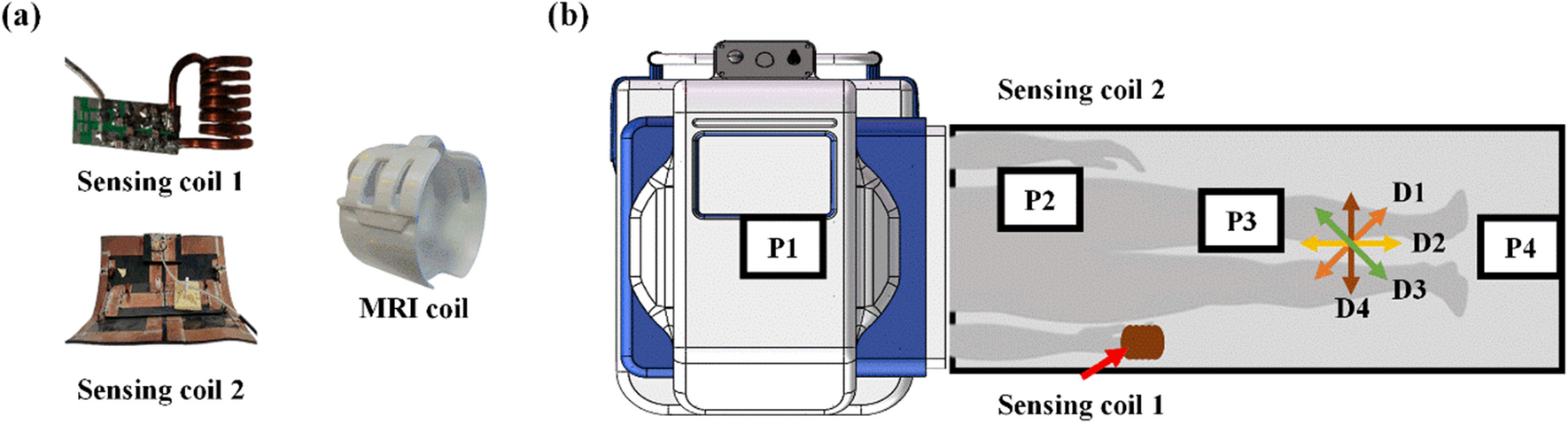 Fast, high-quality, and unshielded 0.2 T low-field mobile MRI using minimal hardware resources