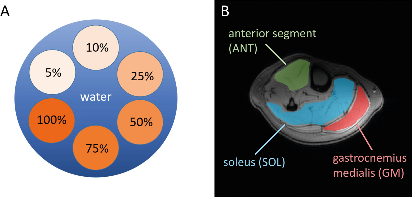 Parameter optimization for proton density fat fraction quantification in skeletal muscle tissue at 7 T