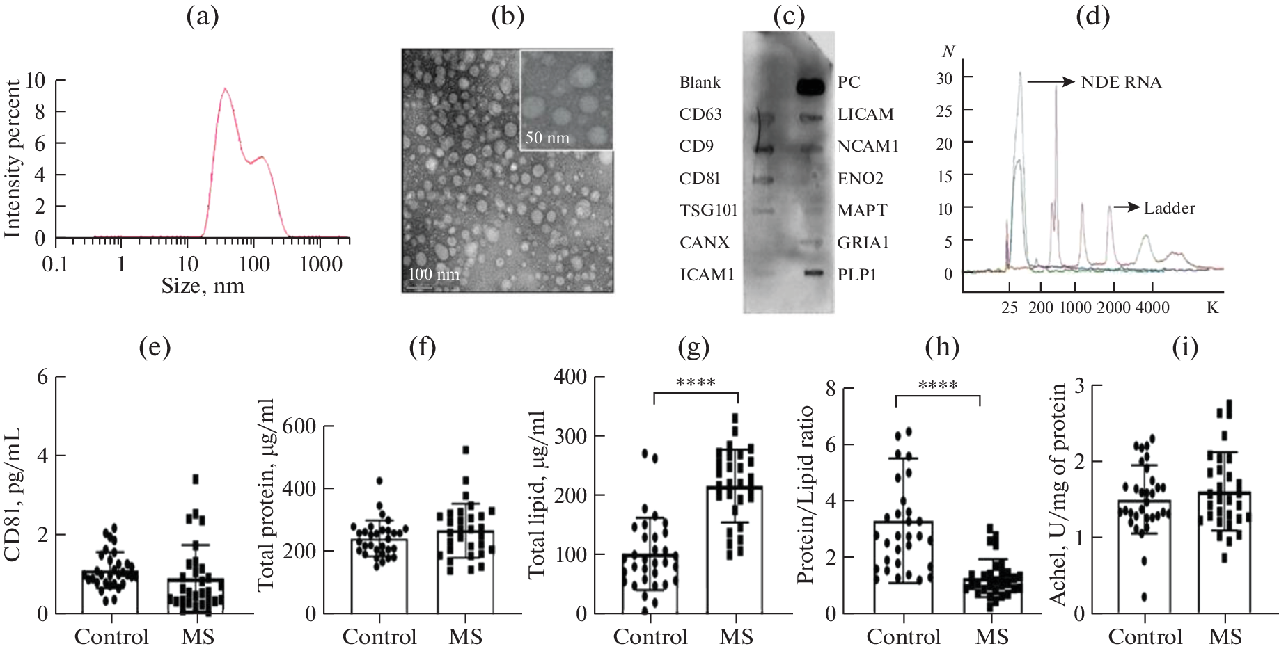 Establishment of Neurofilament Light Chain in Plasma-Derived Neuronal Extracellular Vesicles as a Biomarker for Disease Progression in Multiple Sclerosis Patients