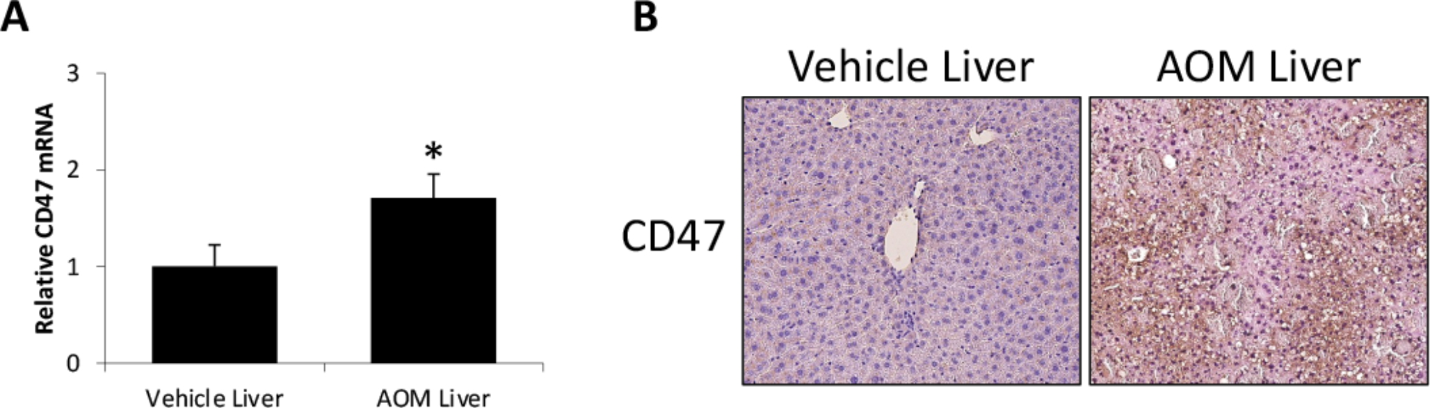CD47 signaling induces hepatic cell death and microglia activation during hepatic encephalopathy