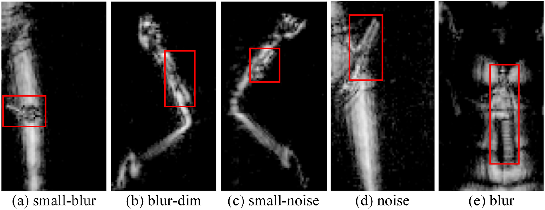 Hybrid network with difficult–easy learning for concealed object detection in imbalanced terahertz image dataset