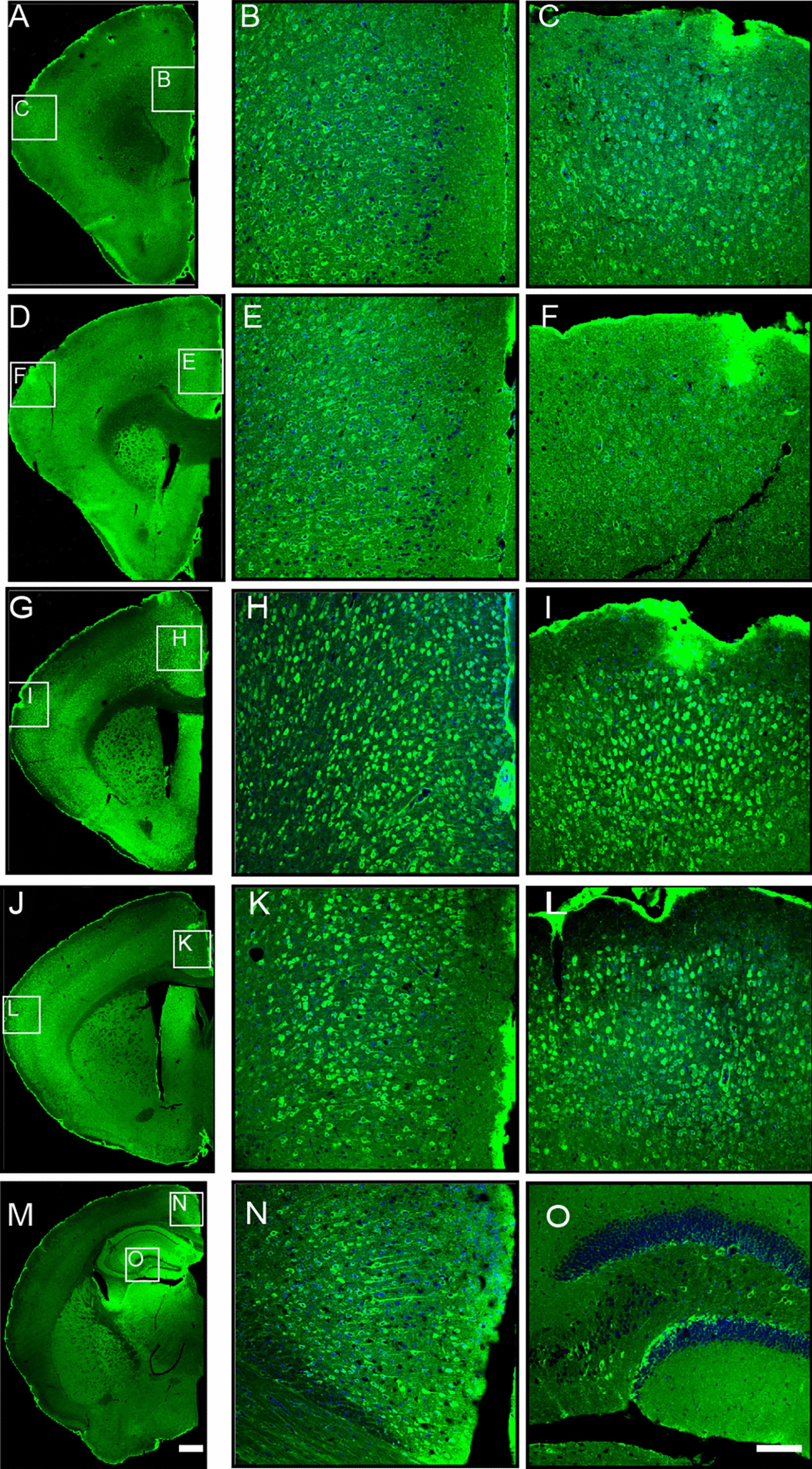 Deciphering the Role of Shank3 in Dendritic Morphology and Synaptic Function Across Postnatal Developmental Stages in the Shank3B KO Mouse