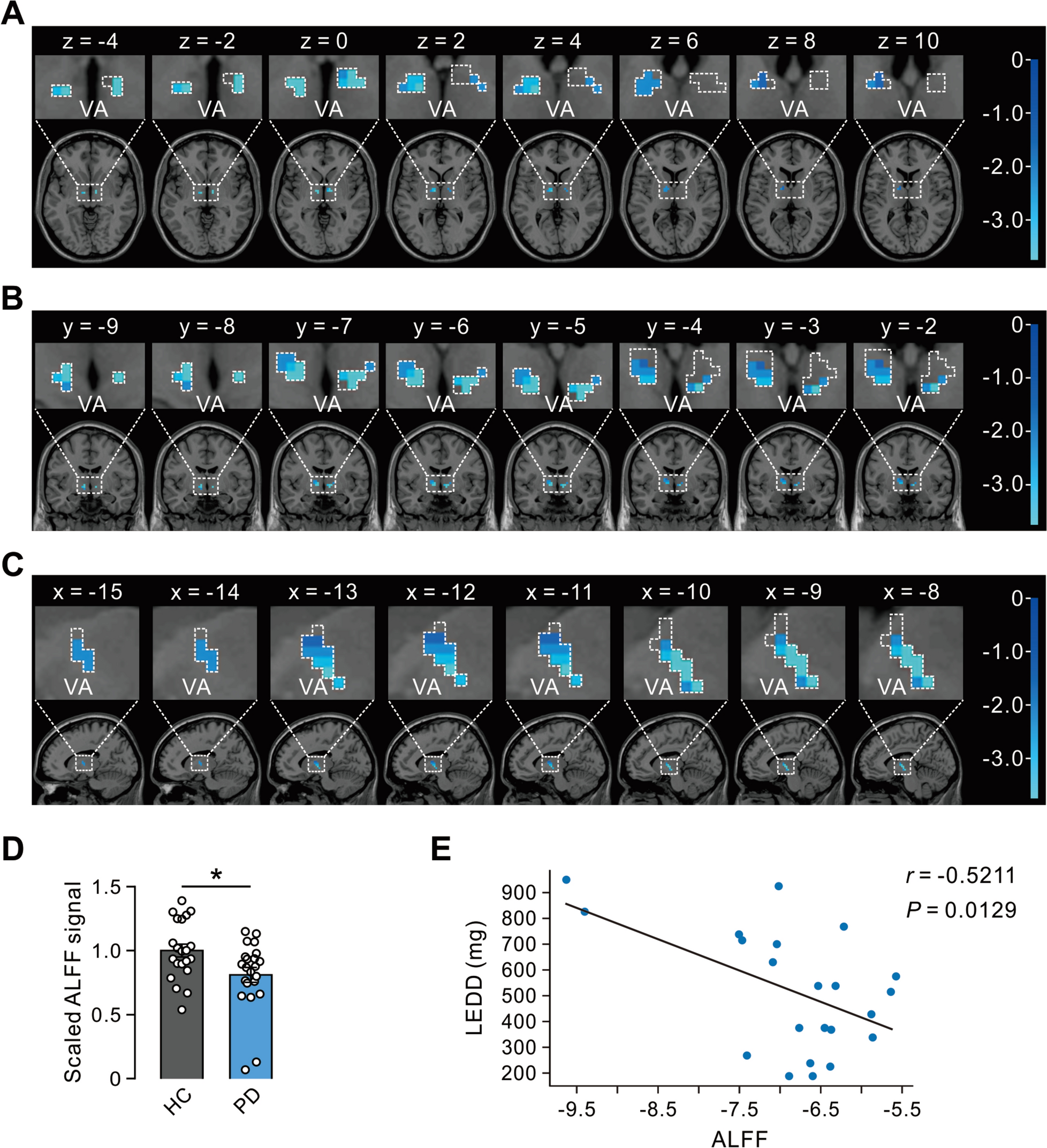 Histaminergic Innervation of the Ventral Anterior Thalamic Nucleus Alleviates Motor Deficits in a 6-OHDA-Induced Rat Model of Parkinson’s Disease