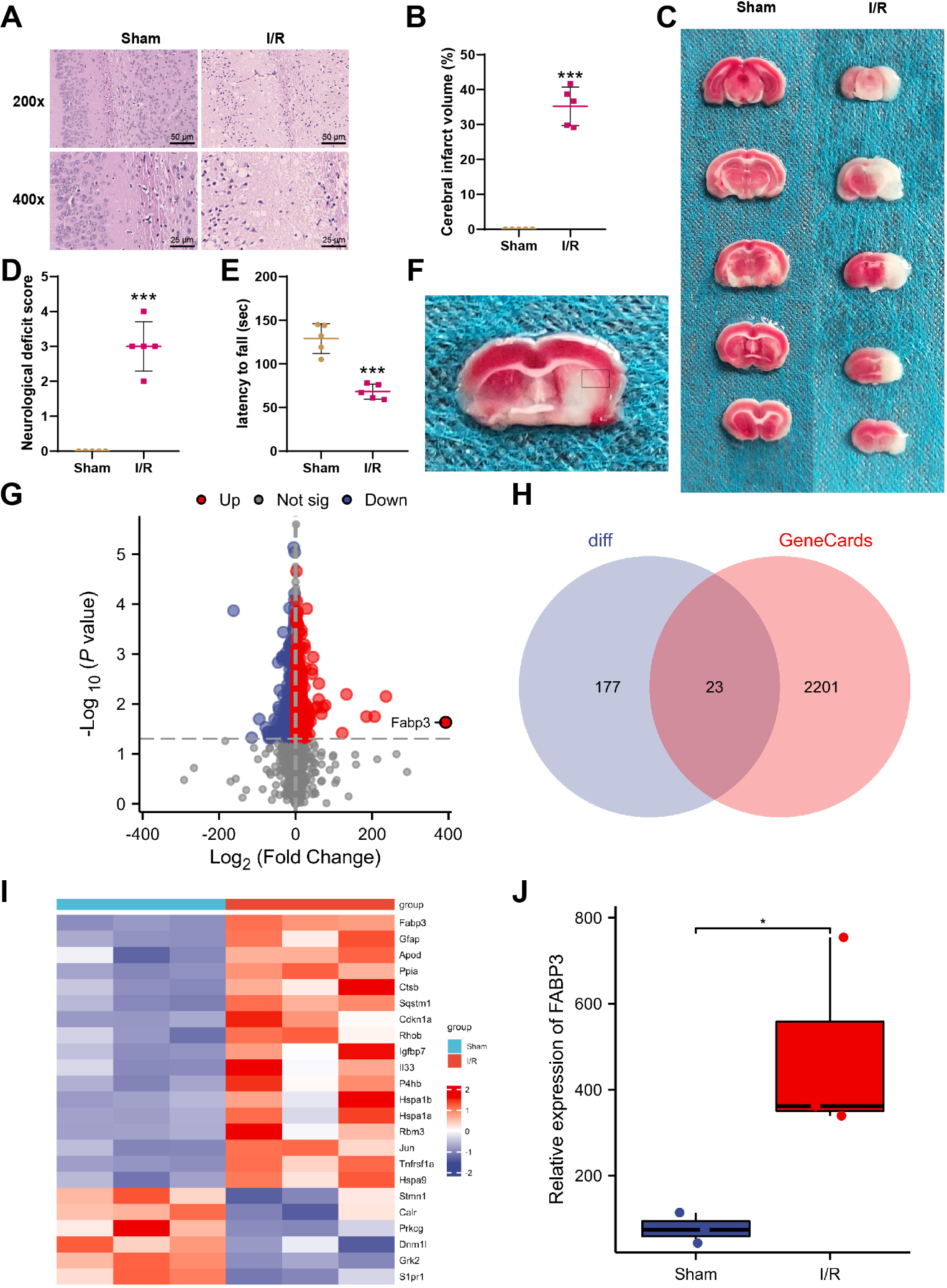 FABP3 Induces Mitochondrial Autophagy to Promote Neuronal Cell Apoptosis in Brain Ischemia-Reperfusion Injury