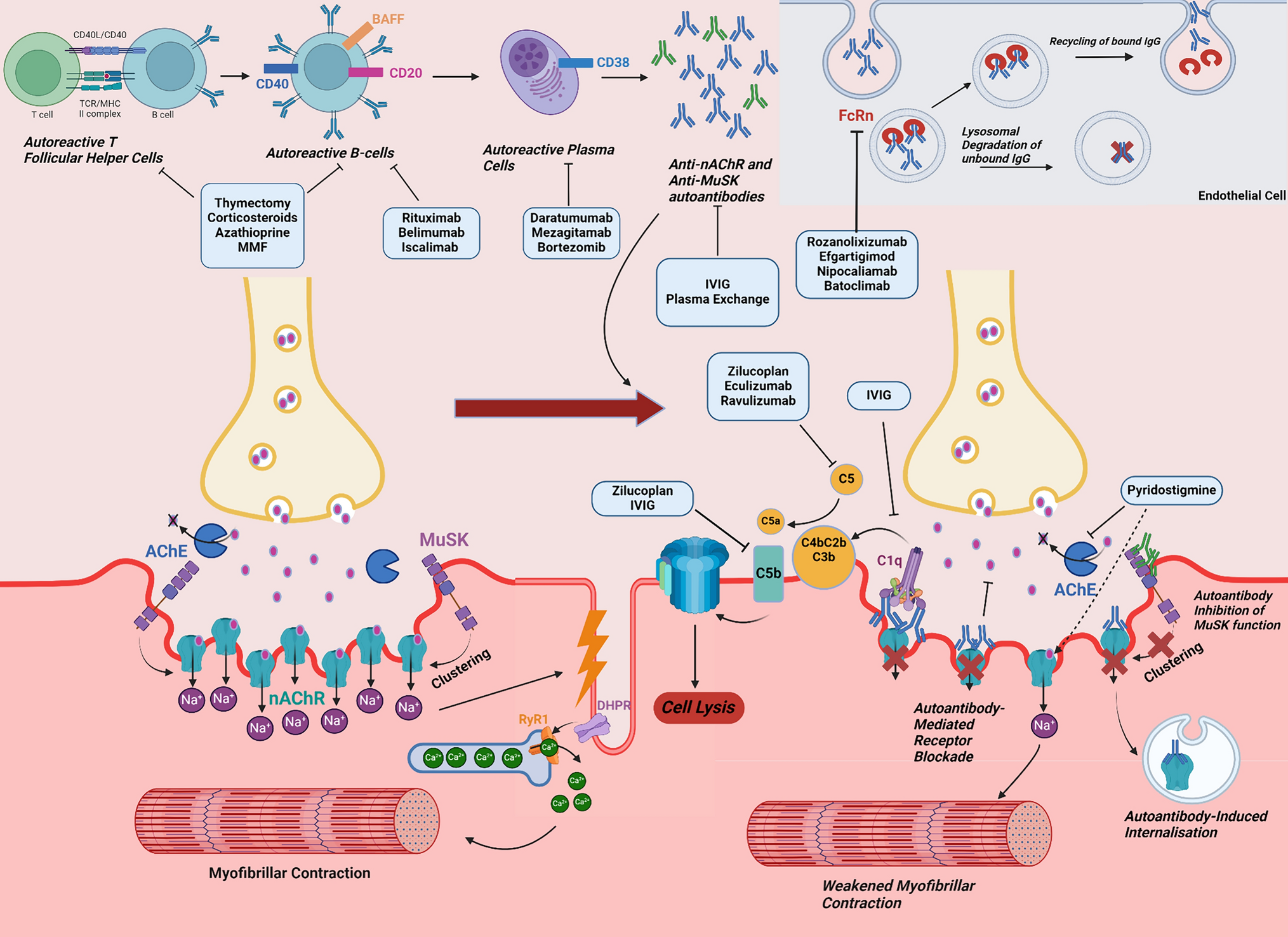 Targeted Treatments for Myasthenia Gravis in Children and Adolescents