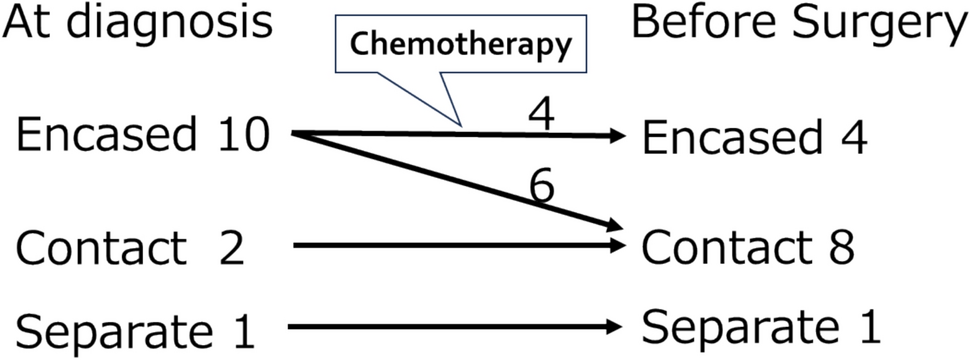 Impact of the relationship between renal pedicles and tumors on surgical outcomes for non-high-risk abdominal neuroblastoma