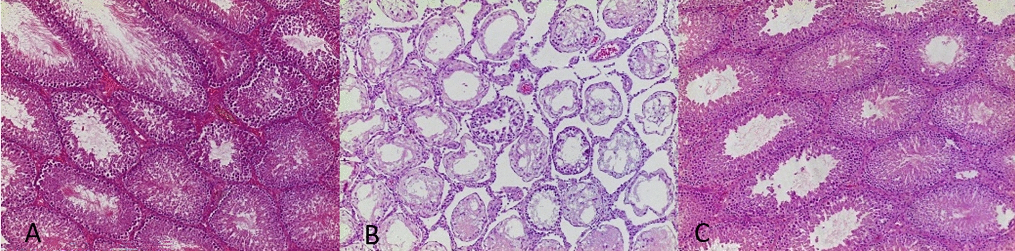 Involvement of autophagy in germ cells in an experimental model of varicocele in rats before and after varicocelectomy