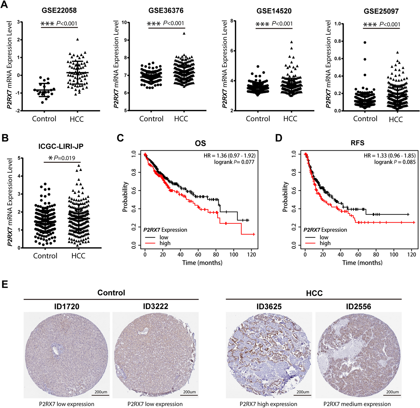 Antagonism of the ATP-gated P2X7 receptor inhibits the proliferation of hepatocellular carcinoma cells