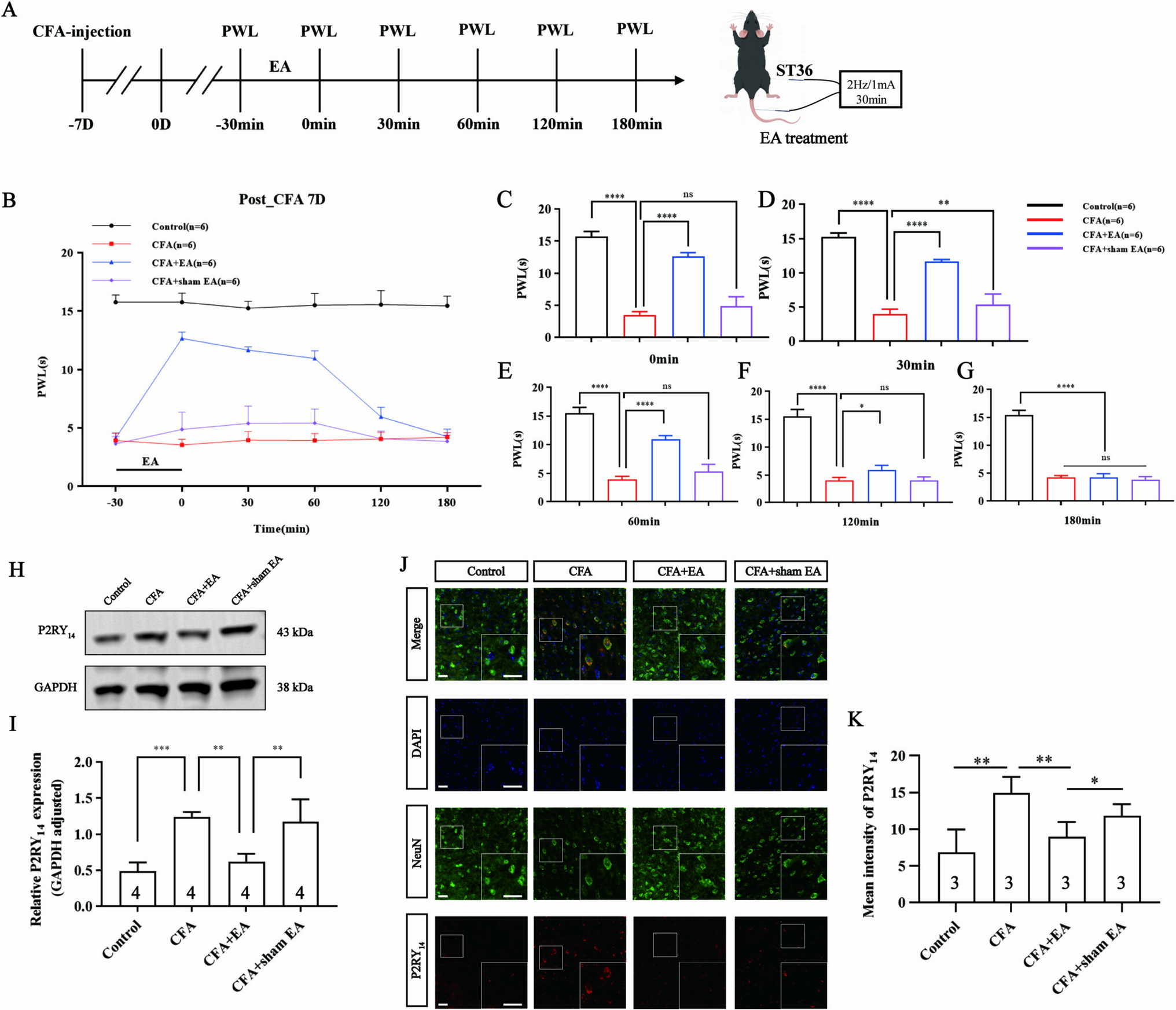 Electroacupuncture may alleviate inflammatory pain by downregulating the expression of P2Y14 receptor in the primary somatosensory cortex
