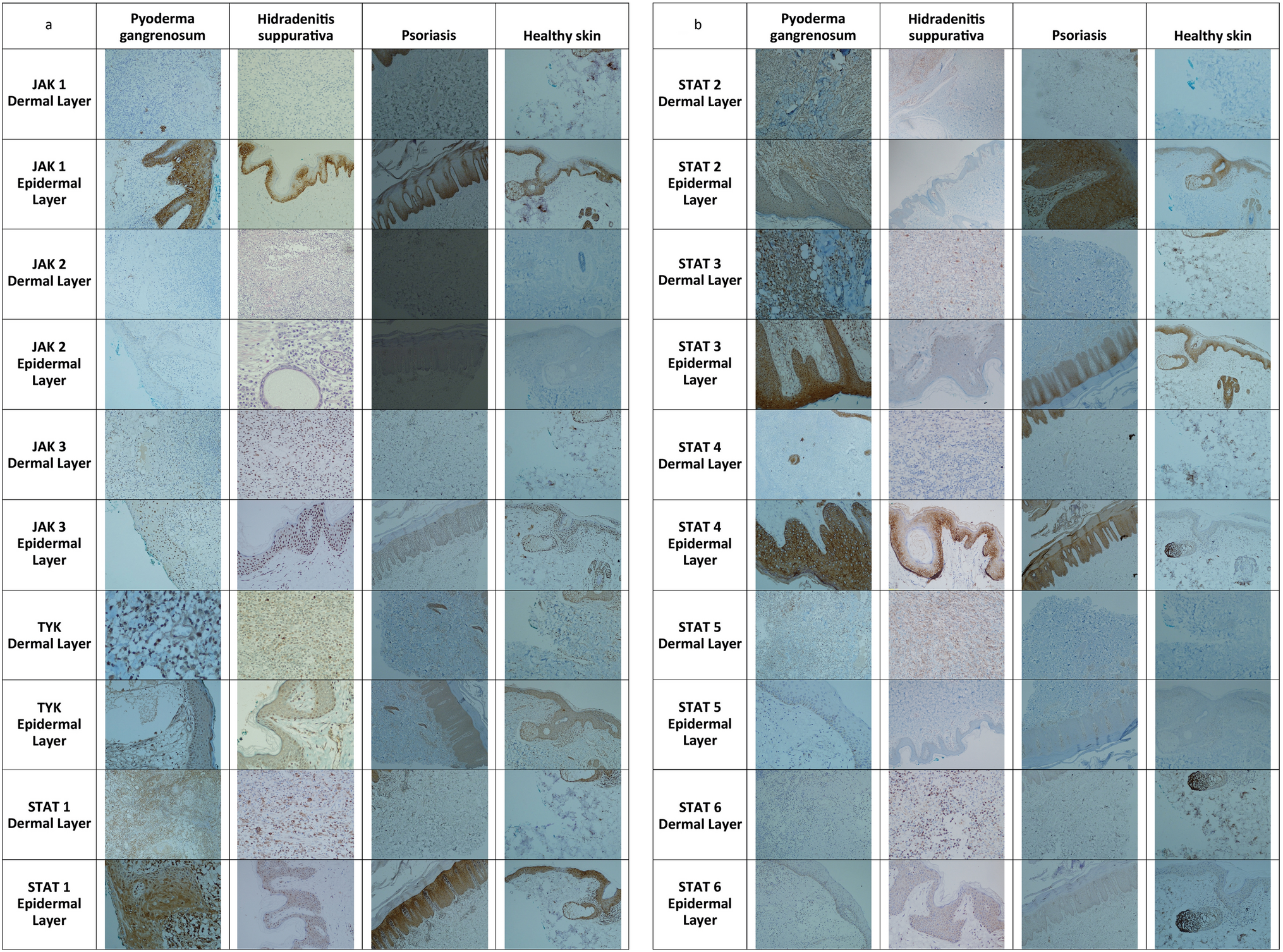 Quantitative analysis of JAK/STAT signaling pathway in patients of inflammatory skin disorders