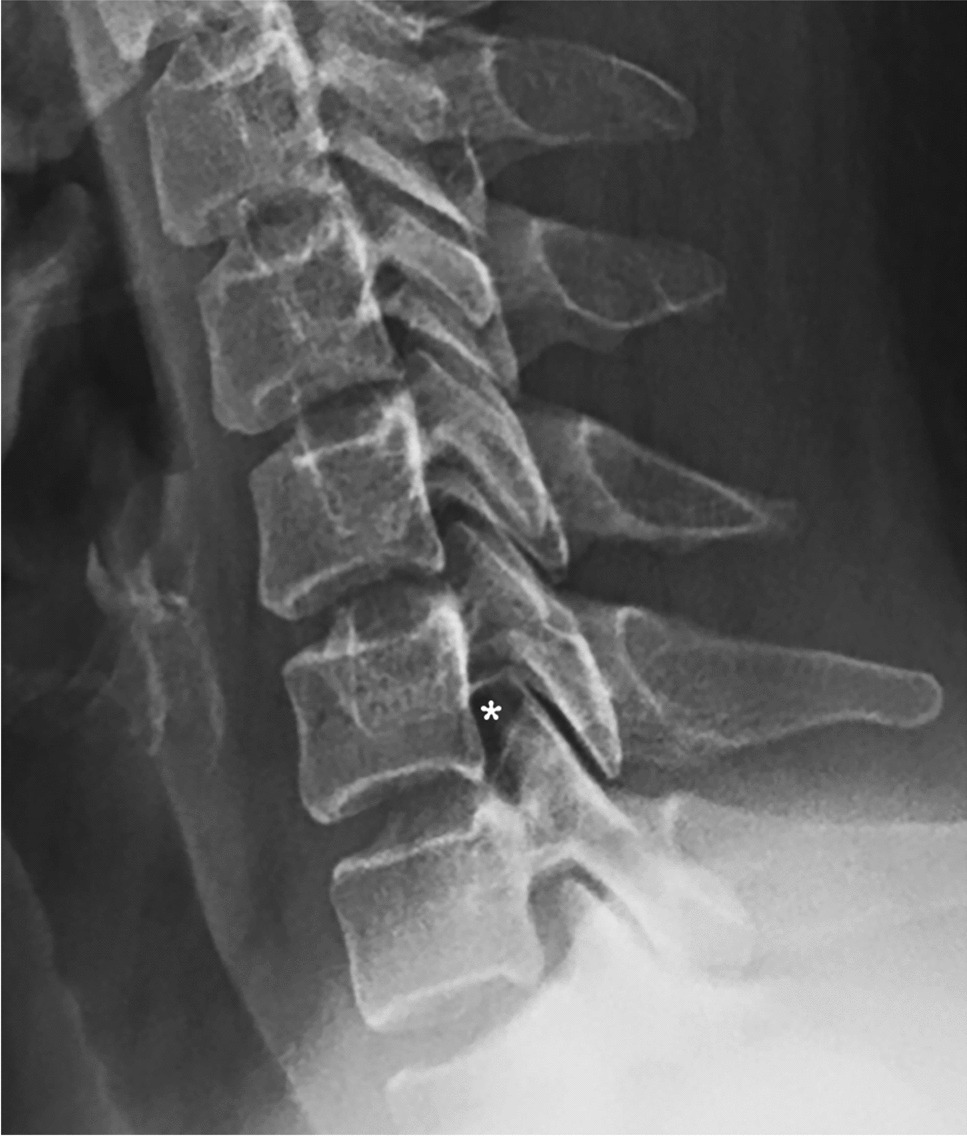 Test Yourself: neck pain in a 32-year-old female