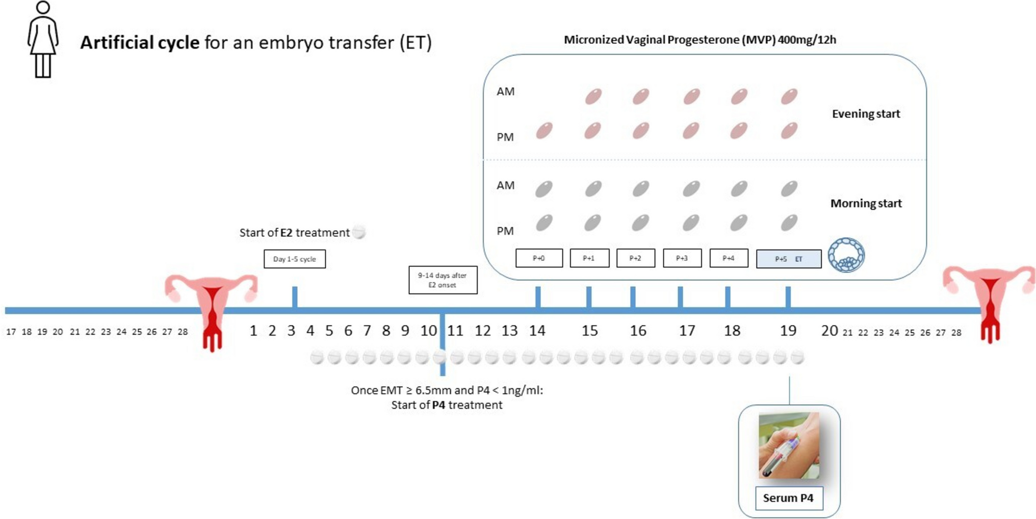 A 12-h Difference in Exogenous Progesterone Initiation Does Not Have an Impact on Ongoing Pregnancy Rates in Artificial Cycles, as Long as Luteal Phase Support Starts Five Days Before Blastocyst Transfer