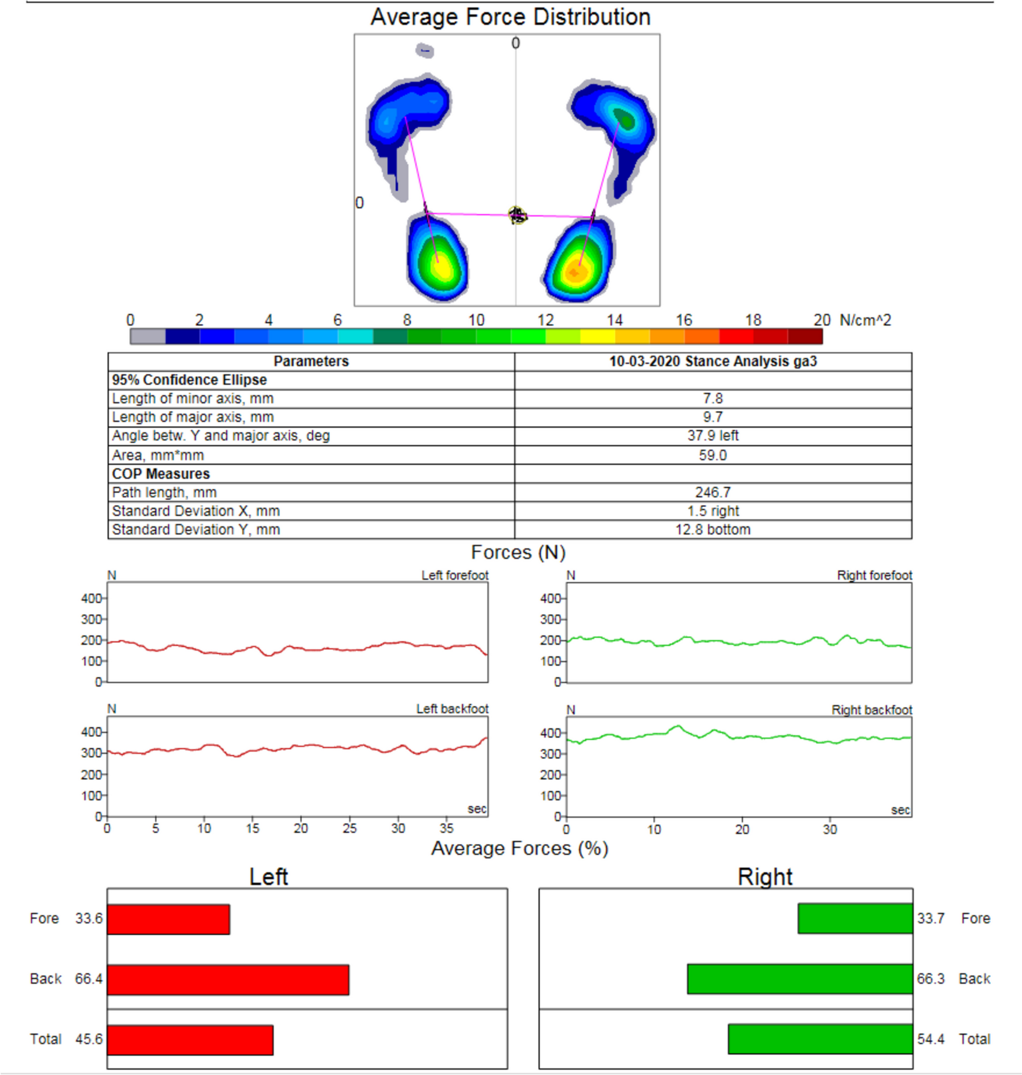 The effects of sleep deprivation on the balance system: following normal sleep, 24 h of sleep deprivation, and rest under eyes-open and eyes-closed conditions
