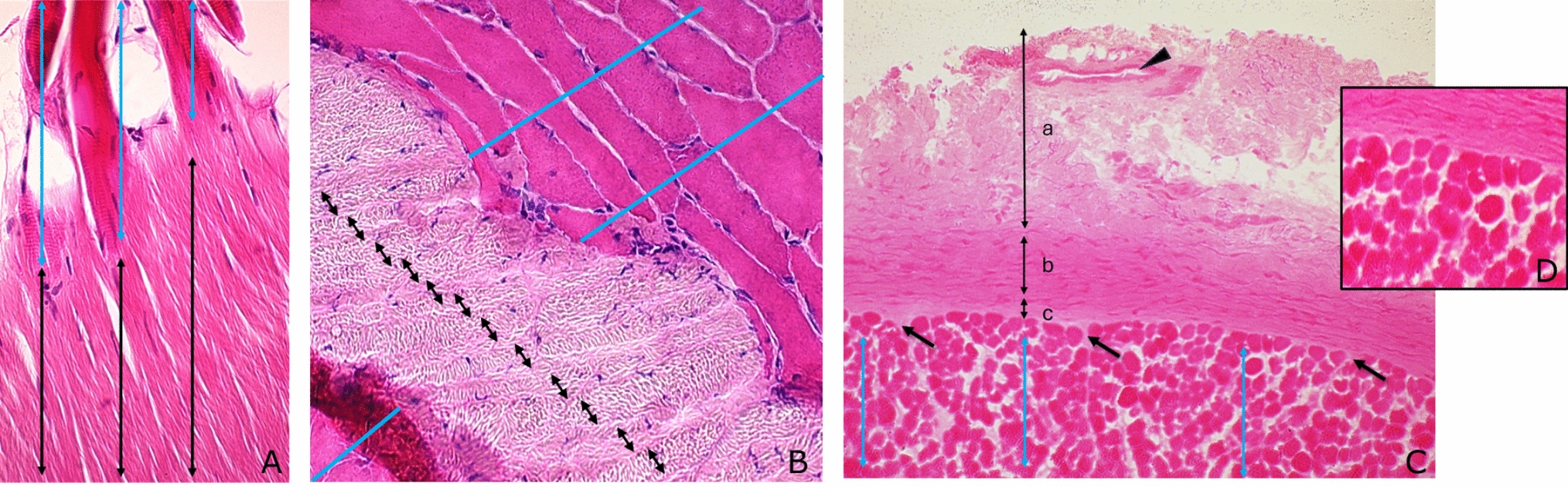 Histological Definition of Skeletal Muscle Injury: A Guide to Nomenclature Along the Connective Tissue Sheath/Structure