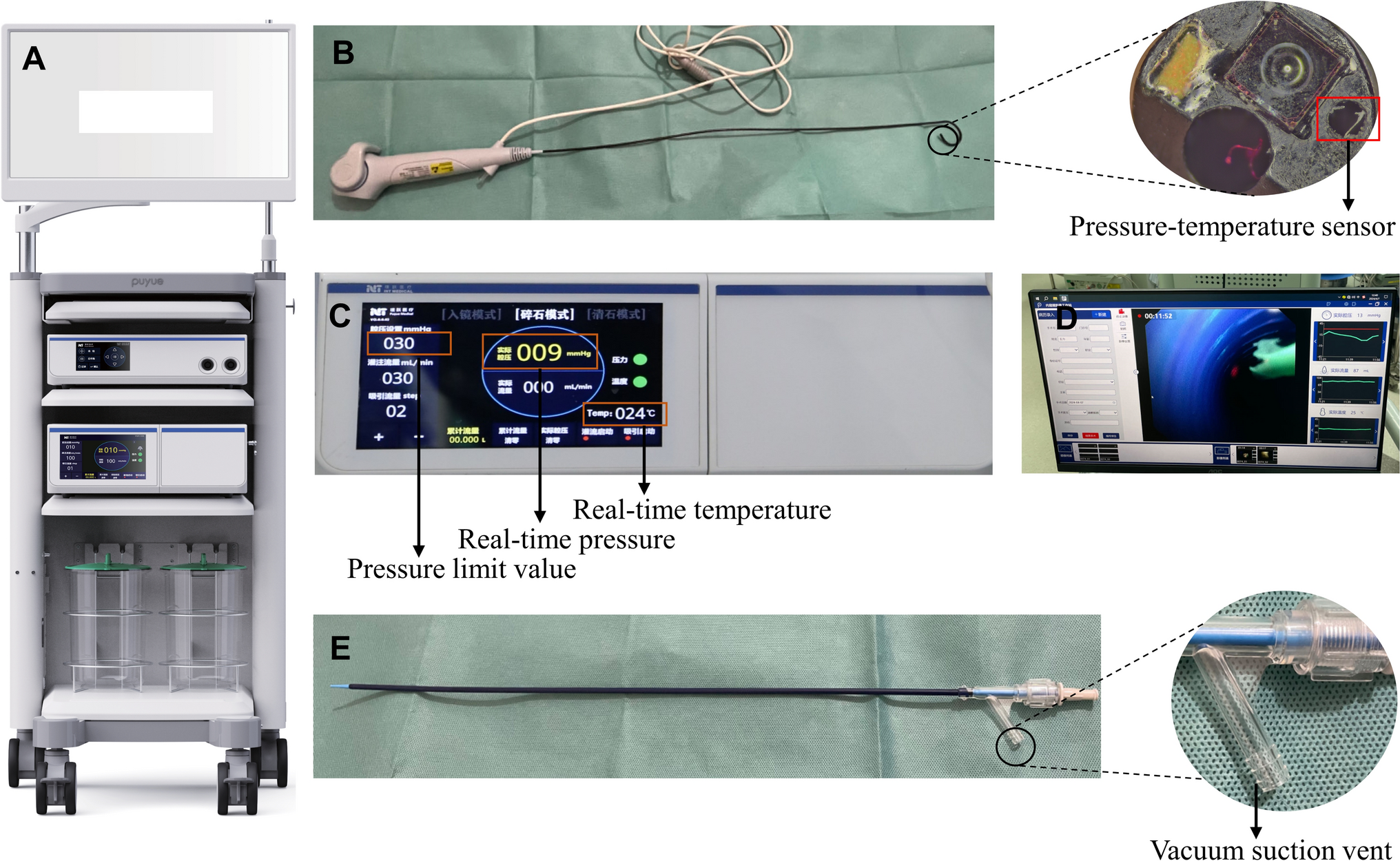 Novel pressure- and temperature-controlled flexible ureteroscope system with a suction ureteral access sheath: a multicenter retrospective feasibility study