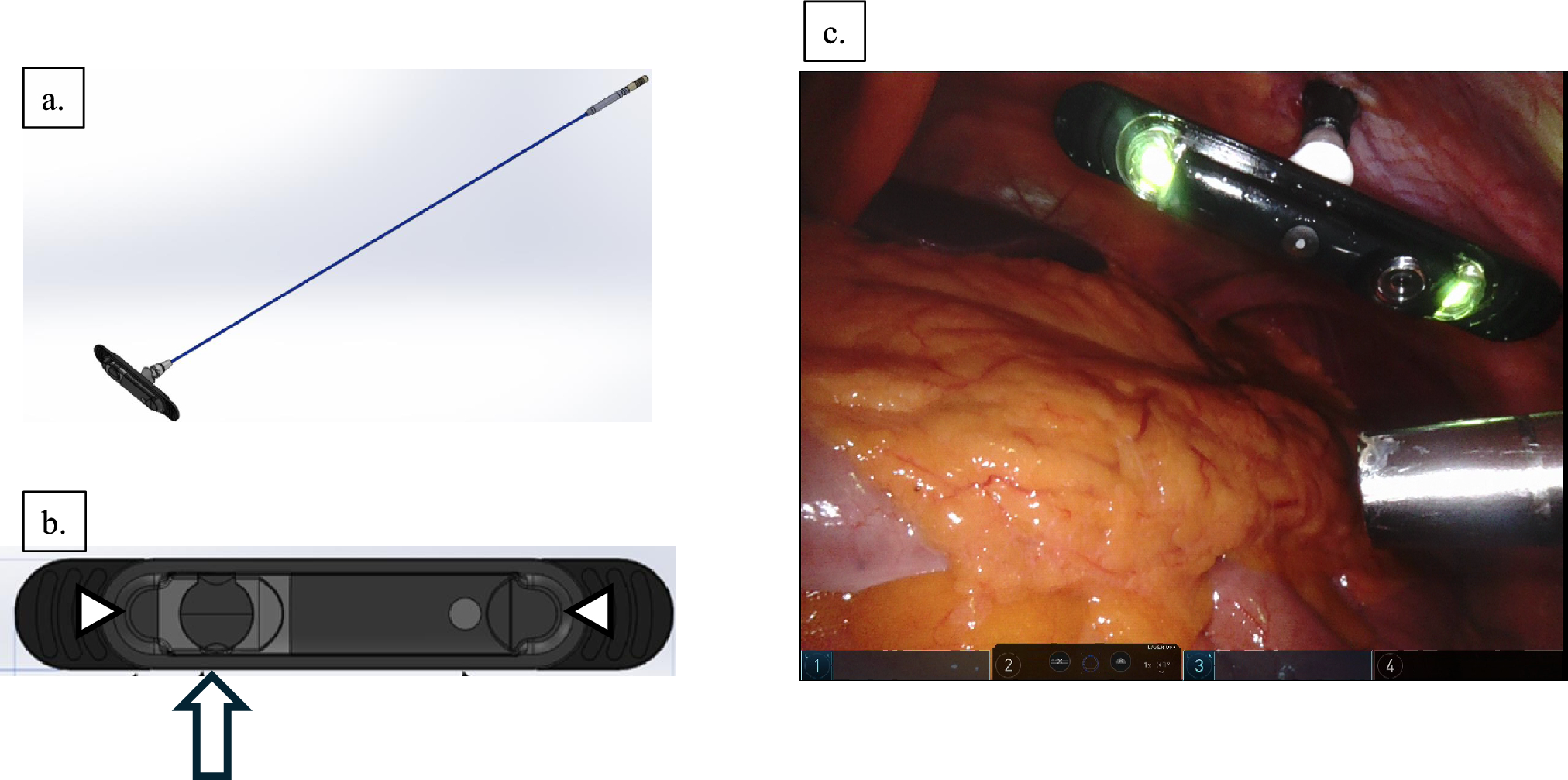 A prospective study on the enhancement of surgical safety in robotic surgery: The BirdView camera system
