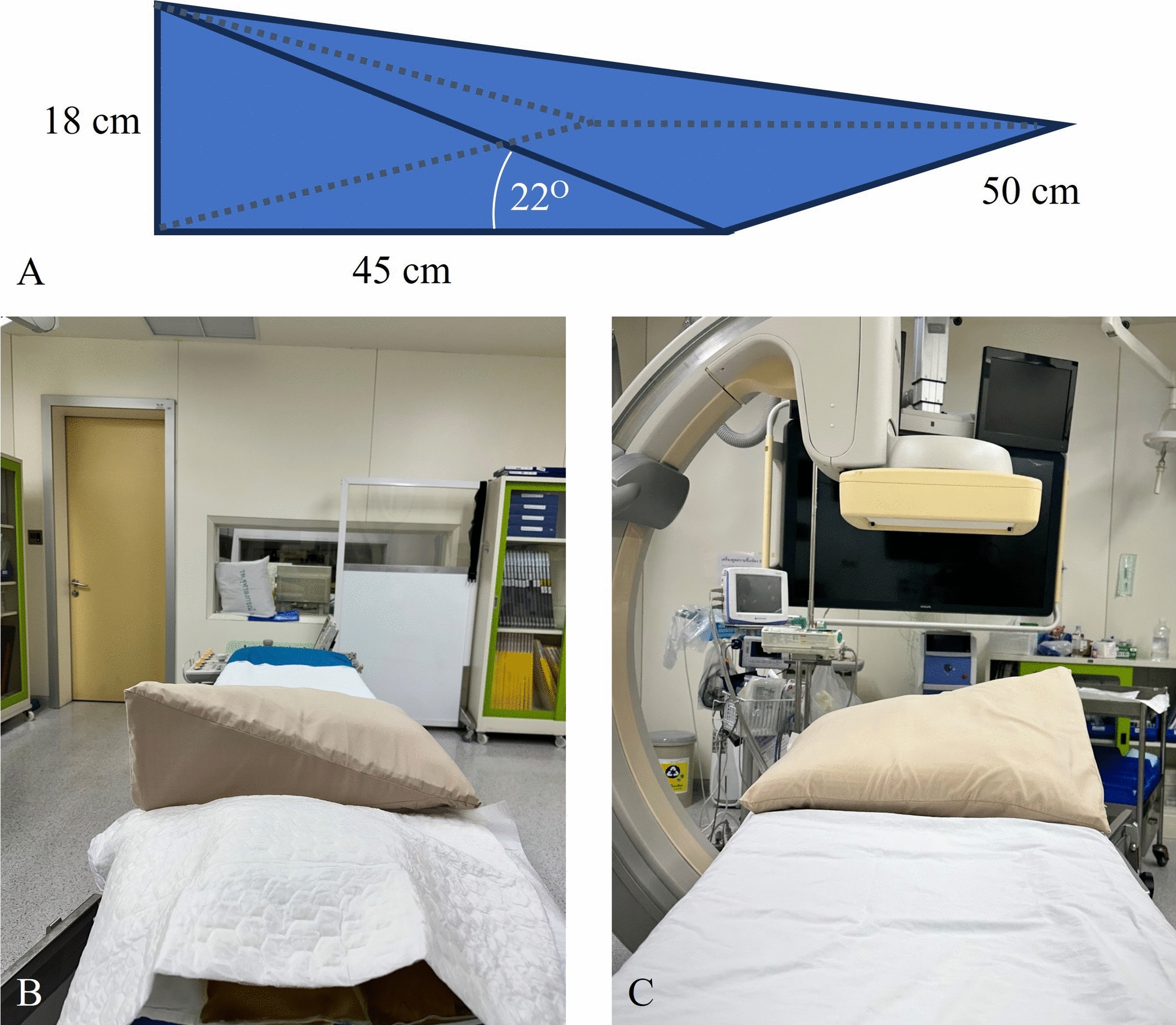 Ergonomic wedge pillow to reduce neck pain after prone ERCP; a randomized, controlled study